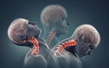 Китайской пациентке вживили напечатанный на 3D принтере позвоночник